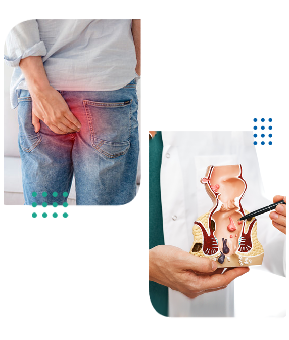 Piles Doctor in Faridabad