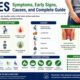 Piles symptoms