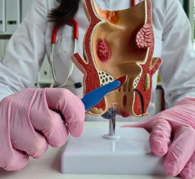 Piles Doctor in Faridabad